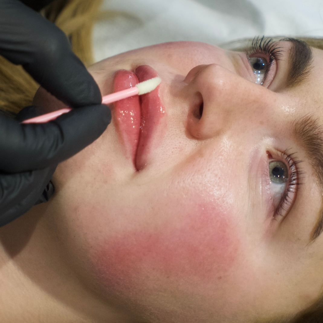 How to Reduce Swelling After Dermal Filler