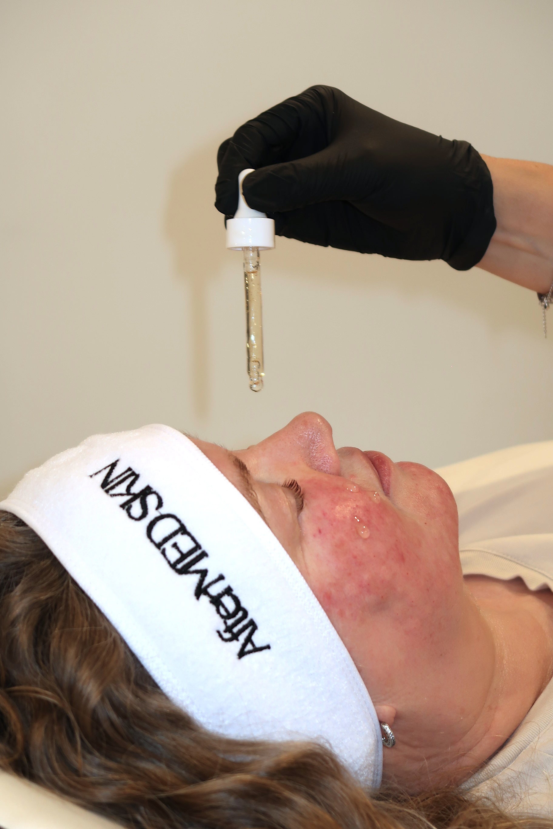 What Should I Put on My Skin After Microneedling? A Complete Guide to Safe Microneedling Aftercare