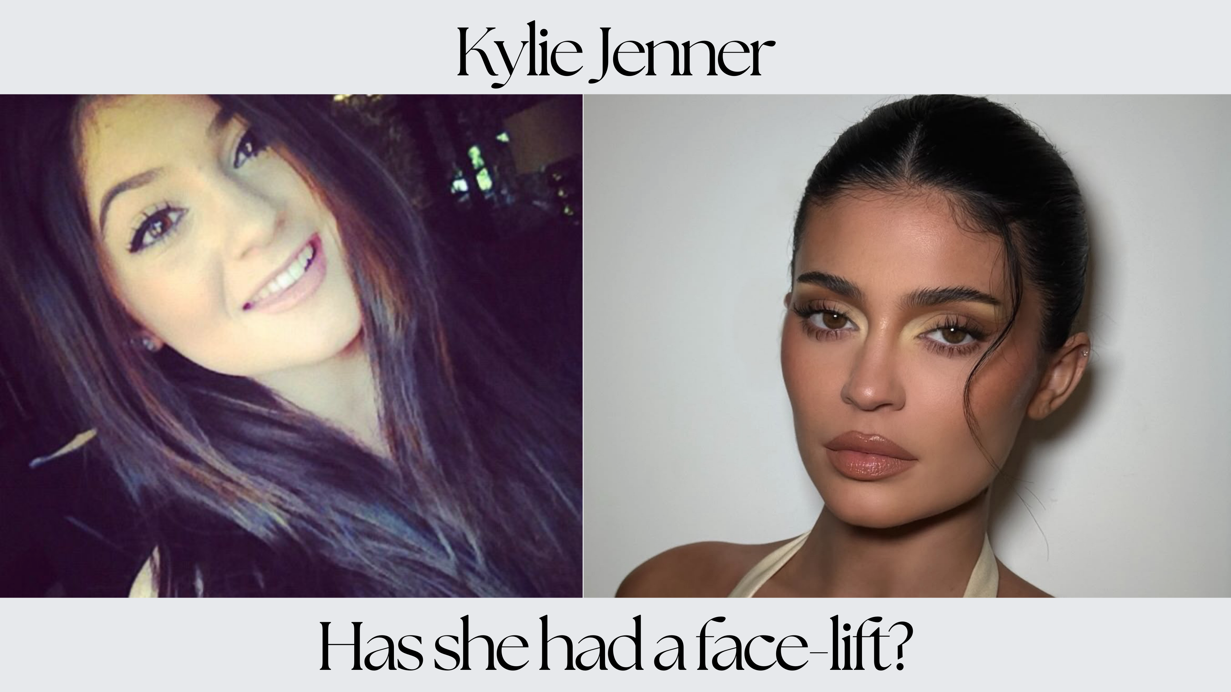 Kylie Jenner Plastic Surgery: Facelifts, Fillers, and What We Really Know