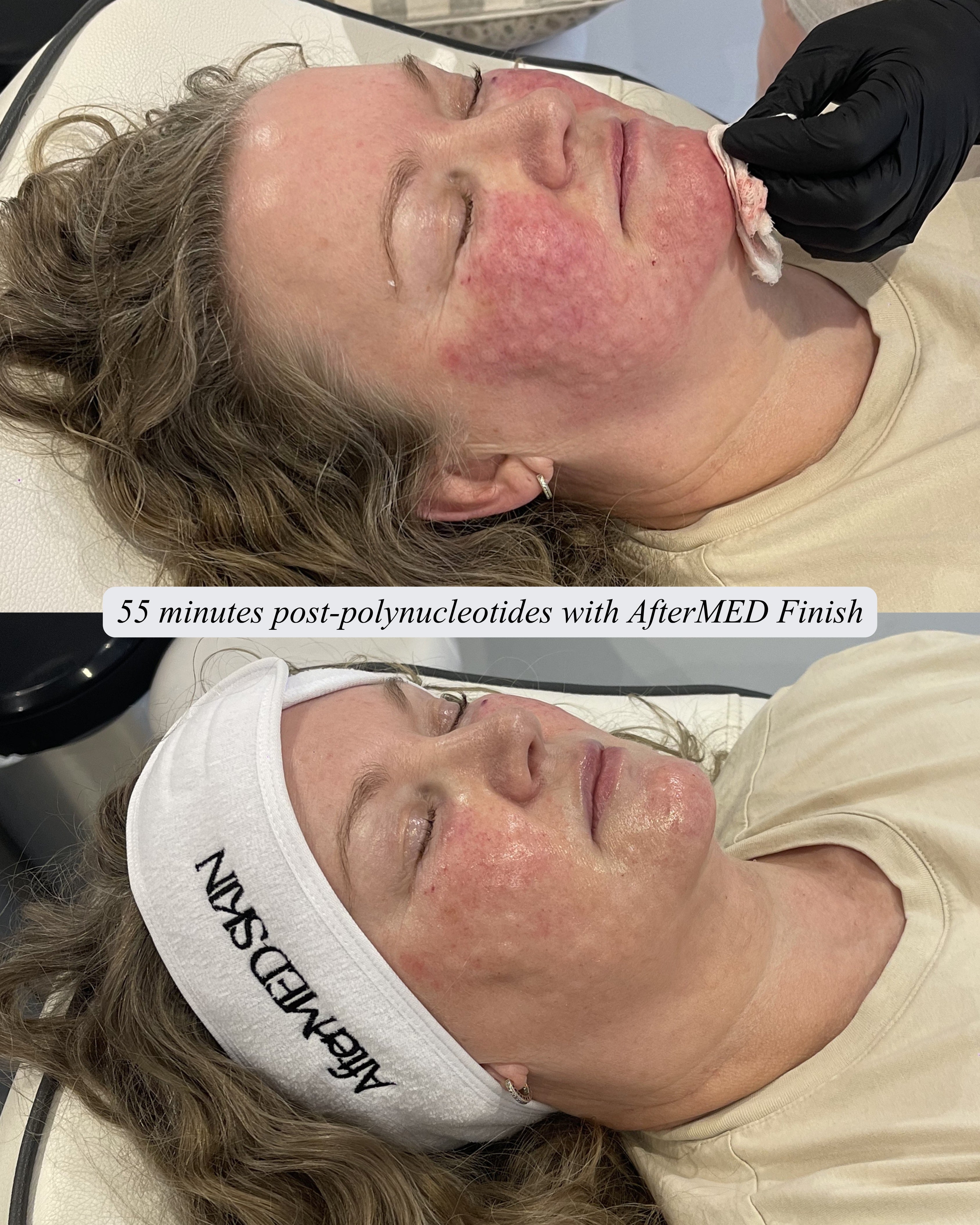 AfterMED Finish