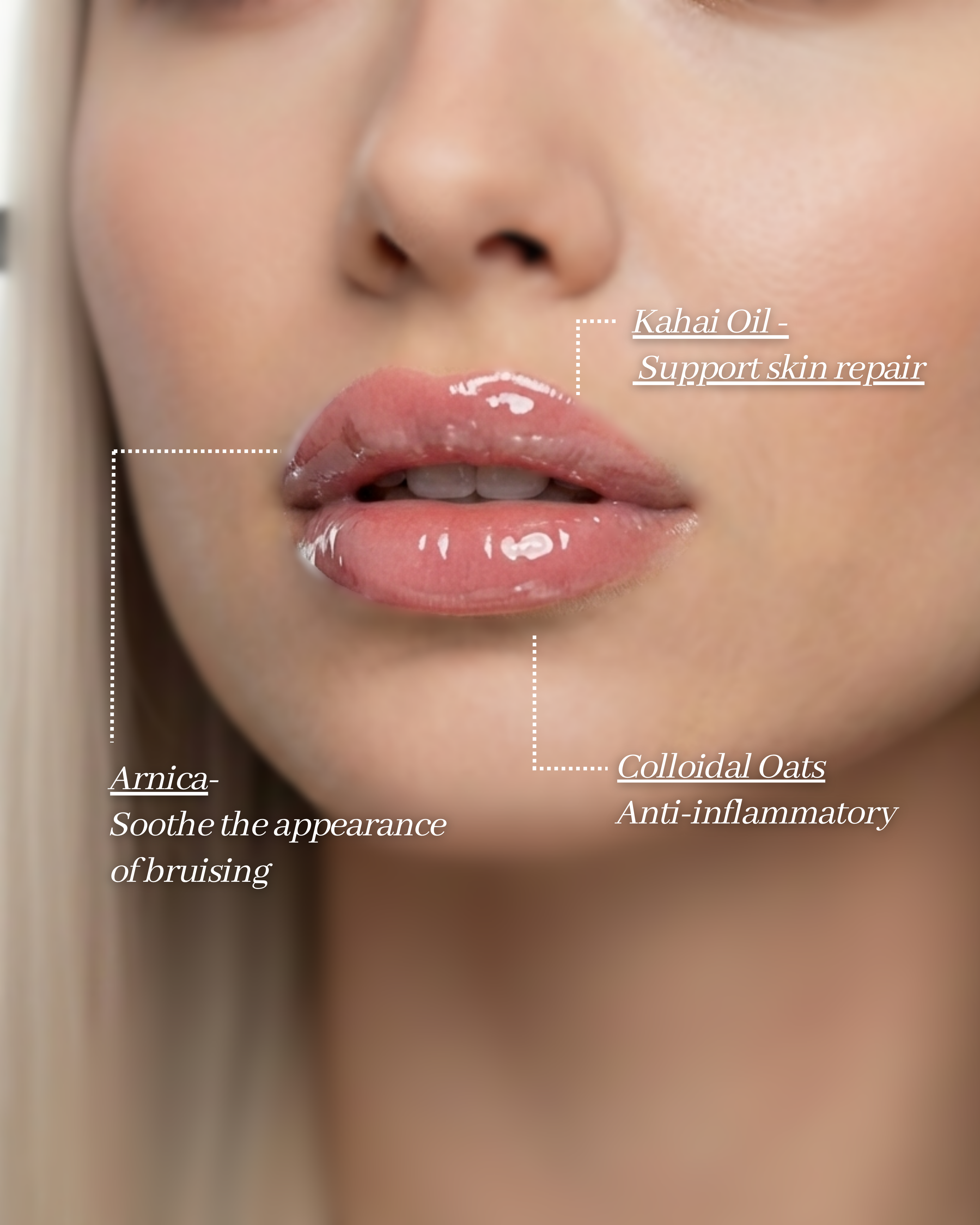 AfterMED Lips Mini