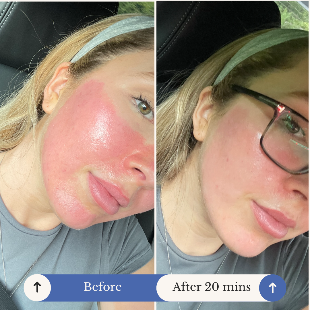 AfterMED Lips - Aftercare For Microneedling