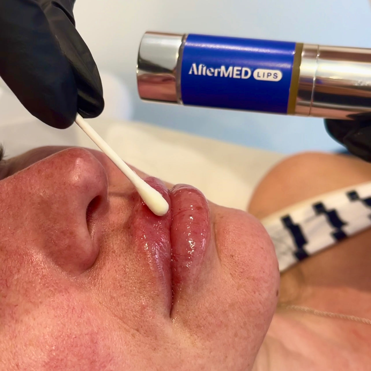 How does AfterMED Lips work?