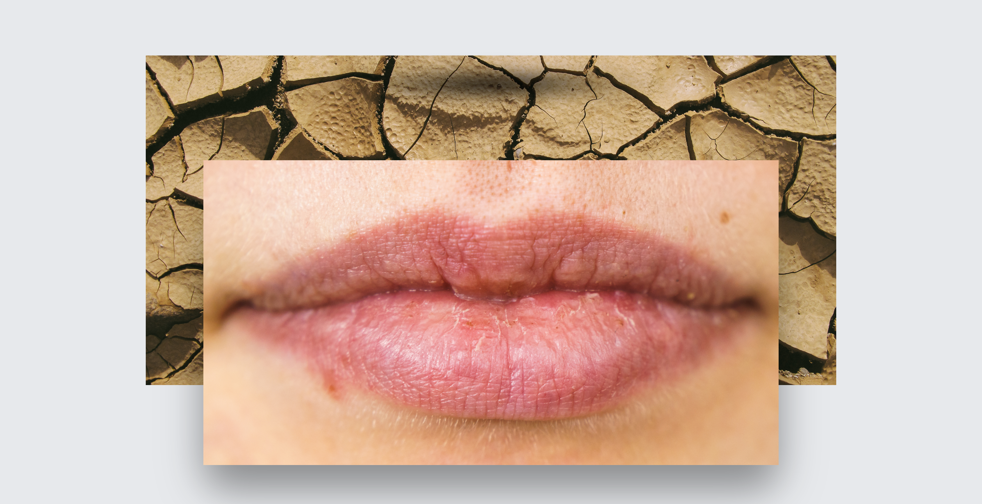 "Why are my lips always dry in winter?"