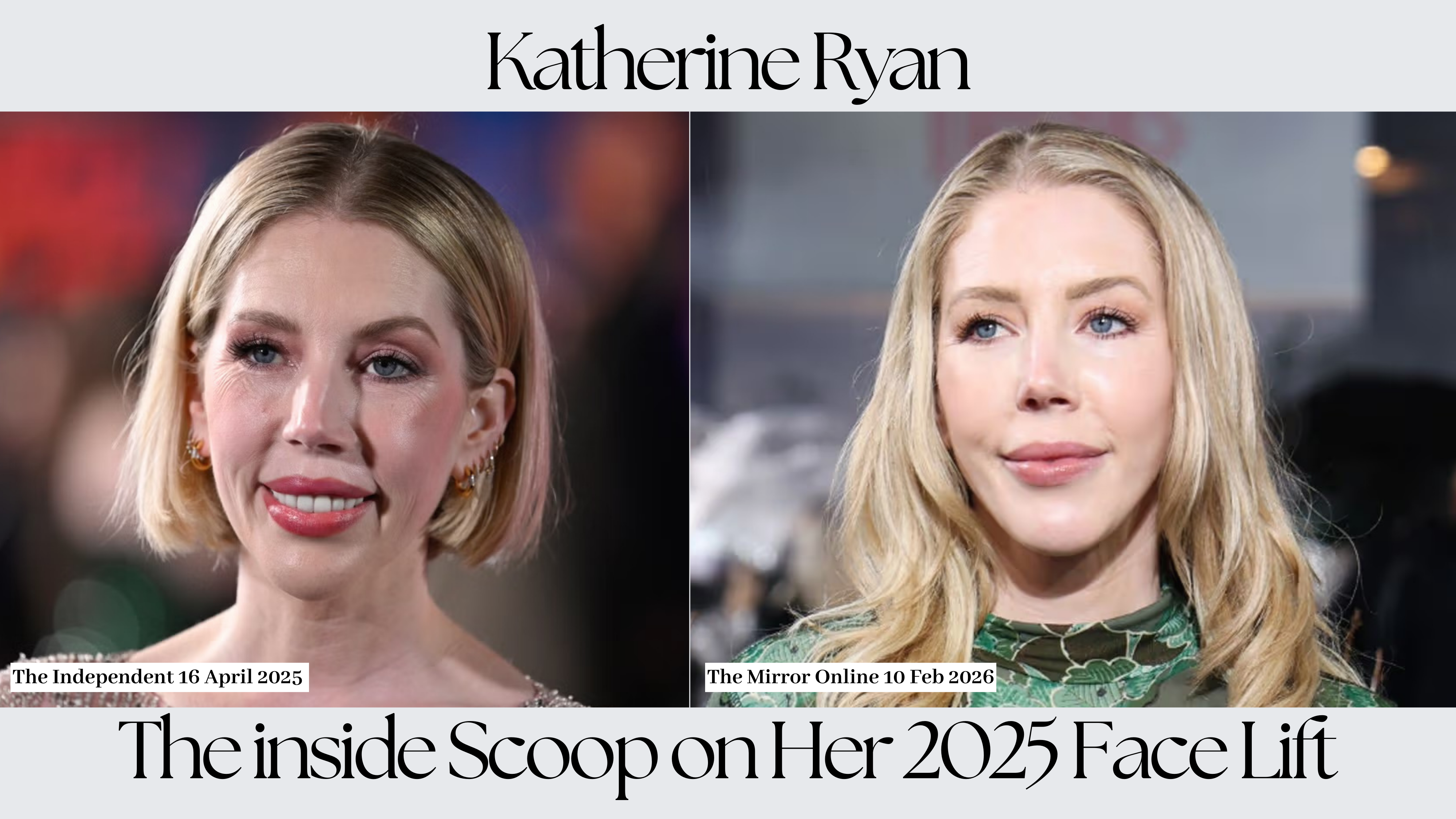 Katherine Ryan 2025 Face lift