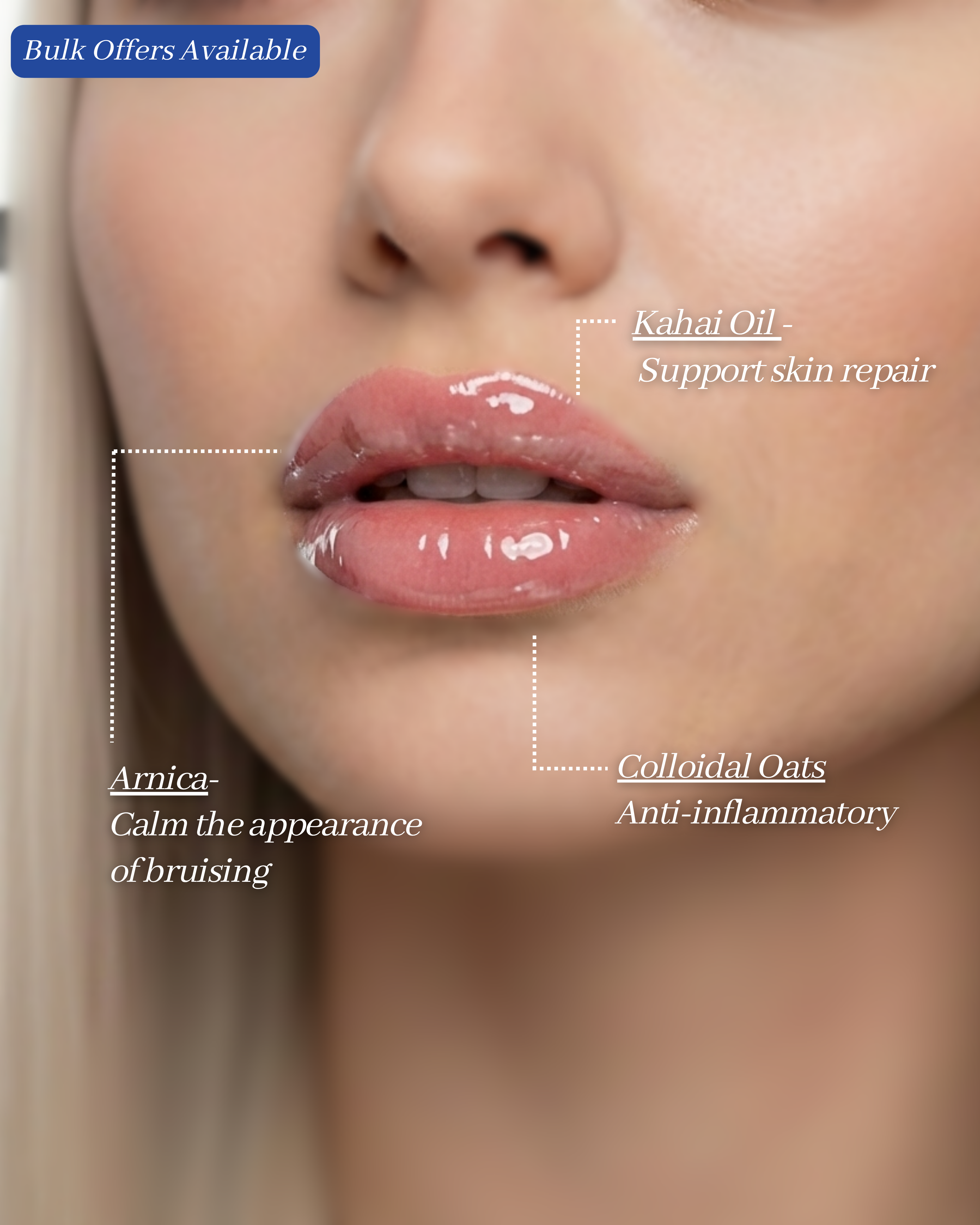 AfterMED Lips Mini (4ml)