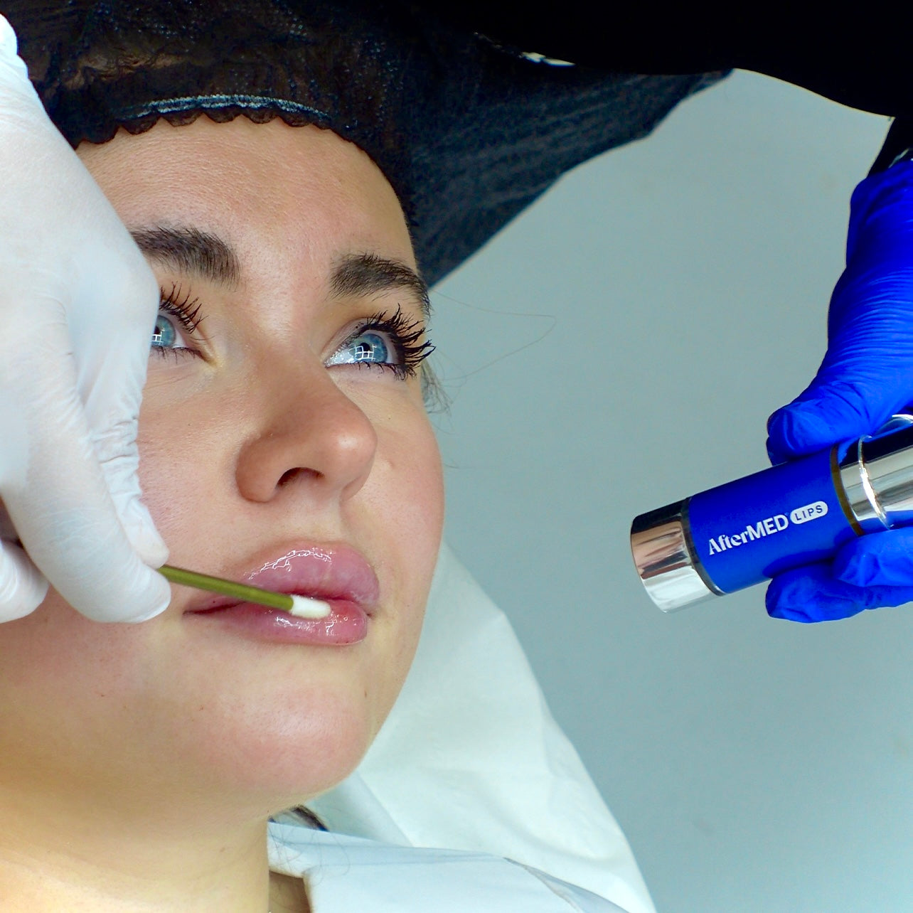 AfterMED Lips - Aftercare For Lip Filler